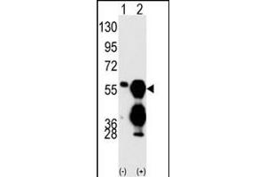 Western blot analysis of M1F (arrow) using M1F Antibody (C-term) (ABIN392884 and ABIN2842288). (PPM1F 抗体  (C-Term))