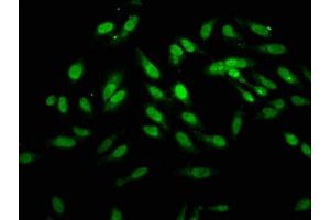 Immunofluorescence staining of Hela cells with ABIN7155739 at 1:166, counter-stained with DAPI. (HOXB4 抗体  (AA 88-166))