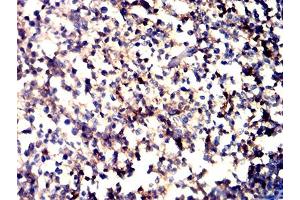 Immunohistochemical analysis of paraffin-embedded tonsil tissues using CD11a mouse mAb with DAB staining.