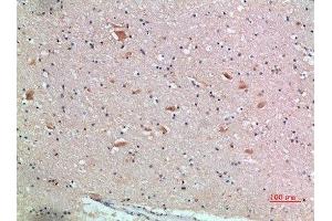 Immunohistochemical analysis of paraffin-embedded human-brain, antibody was diluted at 1:200 (FZD9 抗体  (AA 1-50))