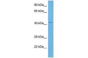 Host:  Rabbit  Target Name:  RNF135  Sample Tissue:  Human OVCAR-3 Whole Cell  Antibody Dilution:  1ug/ml (RNF135 抗体  (Middle Region))