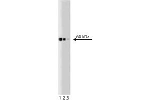 Western blot analysis of Hsp60 on a Jurkat lysate (ABIN968537). (HSPD1 抗体)