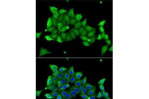 Immunofluorescence analysis of A-549 cells using CA1 Polyclonal Antibody (CA1 抗体)