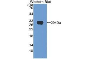 Detection of Recombinant HEXa, Human using Polyclonal Antibody to Hexosaminidase A Alpha (HEXa) (Hexosaminidase A 抗体  (AA 318-529))