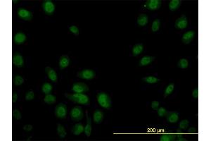 Immunofluorescence (IF) image for anti-Sp1 Transcription Factor (SP1) (AA 89-198) antibody (ABIN520394)