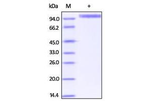 SDS-PAGE (SDS) image for Receptor tyrosine-protein kinase erbB-2 (ErbB2/Her2) (AA 23-652) (Active) protein (His tag,Biotin) (ABIN2444140)