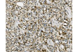 IHC analysis of TRIM25 using anti-TRIM25 antibody (ABIN7599495). (TRIM25 抗体  (AA 1-610))