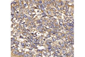 IHC analysis of IFIT5 using anti-IFIT5 antibody (ABIN7600752). (IFIT5 抗体  (AA 23-439))