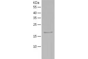 Western Blotting (WB) image for Interleukin 10 (IL10) (AA 19-178) (Active) protein (His tag) (ABIN7123541)