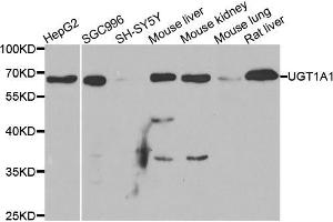 Western blot analysis of extracts of various cell lines, using μgT1A1 antibody (ABIN5973637) at 1/1000 dilution. (UGT1A1 抗体)