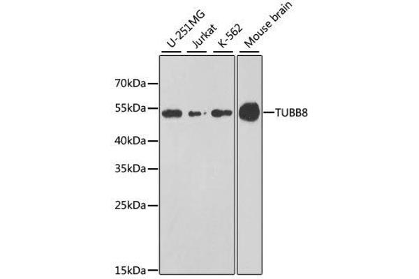 Tubulin, beta 8 抗体