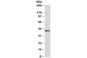 Western blot testing of K562 lysate with HMBS antibody at 0. (HMBS 抗体)
