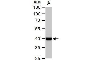WB Image WNT11 antibody detects WNT11 protein by western blot analysis. (WNT11 抗体  (Center))