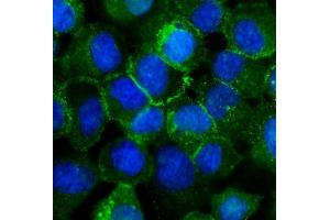 IF analysis of P cadherin/CDH3 using anti-P cadherin/CDH3 antibody (ABIN6719500).