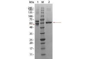 SDS-PAGE of AKT3 Human Recombinant Protein. (AKT3 蛋白)