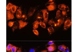 Immunofluorescence analysis of HeLa cells using IGFBP5 Polyclonal Antibody at dilution of 1:100. (IGFBP5 抗体)