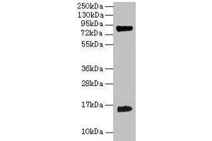 Western blot All lanes: Hemoglobin polyclonal antibody at 2 μg/mL + 293T whole cell lysate Secondary Goat polyclonal to rabbit IgG at 1/15000 dilution Predicted band size: 16 kDa Observed band size: 16 kDa (Hemoglobin 抗体)