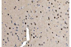 IHC analysis of Serum Response Factor/SRF using anti-Serum Response Factor/SRF antibody (ABIN7600144).