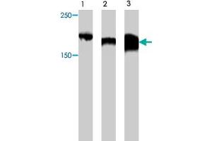 Western blot analysis of extract from Myc-CIBZ protein (lane 1) , mouse brain tissue (lane 2) and mouse kidney tissue (lane 3) , using Zbtb38 polyclonal antibody  . (ZBTB38 抗体)