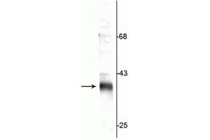 Western blot of rat synaptic plasma membrane (SPM) lysate showing specific immunolabeling of the ~36 kDa stargazin protein. (Stargazin 抗体  (C-Term))