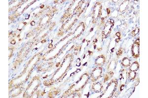 Immunohistochemistry of paraffin-embedded mouse kidney using ACADM Rabbit mAb (ABIN1678538, ABIN3019056, ABIN3019057 and ABIN7101707) at dilution of 1:100 (40x lens). (Medium-Chain Specific Acyl-CoA Dehydrogenase, Mitochondrial 抗体)