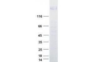 Western Blotting (WB) image for Protein tyrosine Phosphatase, Receptor Type, J (PTPRJ) (Transcript Variant 1) protein (Myc-DYKDDDDK Tag) (ABIN2713433)