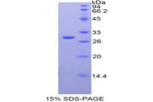 SDS-PAGE analysis of Rat GAL3ST1 Protein.