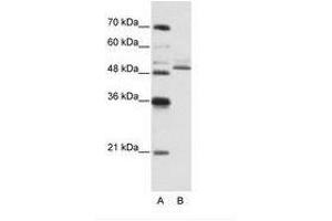 Image no. 3 for anti-Zinc Finger Protein 296 (ZNF296) (C-Term) antibody (ABIN6736191) (Zinc Finger Protein 296 (ZNF296) (C-Term) 抗体)