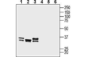 anti-Bradykinin Receptor B1 (BDKRB1) (AA 202-214), (Extracellular) antibody