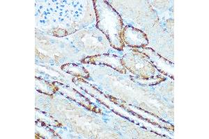 Immunohistochemistry of paraffin-embedded mouse kidney using H Rabbit pAb (ABIN6131125, ABIN6137333, ABIN6137334 and ABIN6220624) at dilution of 1:100 (40x lens). (ATP5H 抗体  (AA 1-161))
