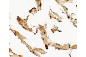 Immunohistochemistry of WDR18 in human lung tissue with WDR18 antibody at 2. (WDR18 抗体  (C-Term))