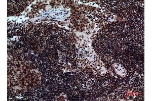 Immunohistochemistry (IHC) analysis of paraffin-embedded Human Lymph Nodes, antibody was diluted at 1:100. (NKp44/NCR2 抗体  (Internal Region))