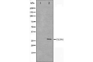 Western blot analysis on NIH-3T3 cell lysate using Claudin 2 Antibody,The lane on the left is treated with the antigen-specific peptide.