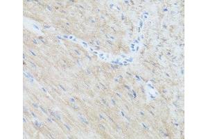 Immunohistochemistry of paraffin-embedded Mouse heart using CLUH Polyclonal Antibody at dilution of 1:100 (40x lens). (CLUH 抗体)