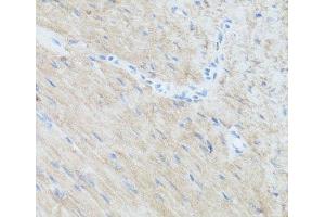 Immunohistochemistry of paraffin-embedded Mouse heart using CLUH Polyclonal Antibody at dilution of 1:100 (40x lens). (CLUH 抗体)