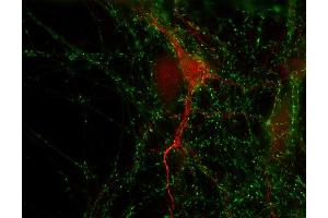Immunocytochemistry (ICC) image for anti-Erythrocyte Membrane Protein Band 4.1 (Elliptocytosis 1, RH-Linked) (EPB41) (AA 1-180) antibody (ABIN1742539)