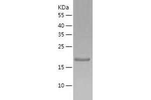 MRGBP Protein (AA 1-204) (His tag)