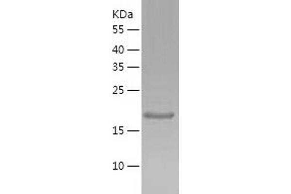 MRGBP Protein (AA 1-204) (His tag)