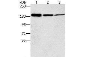 Western Blot analysis of Jurkat, A172 and A549 cell using SMC2 Polyclonal Antibody at dilution of 1:300 (SMC2 抗体)