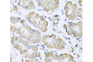 Immunohistochemistry of paraffin-embedded Human stomach using L2HGDH Polyclonal Antibody at dilution of 1:100 (40x lens). (L2HGDH 抗体)