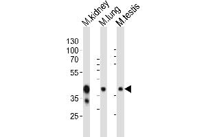 Western blot analysis of lysates from mouse kidney, mouse lung, mouse testis tissue lysate (from left to right), using Epcam Antibody (C-term) (ABIN6242230 and ABIN6577881). (EpCAM 抗体  (C-Term))