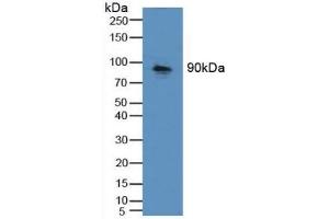 Detection of CDH16 in Mouse Kidney Tissue using Polyclonal Antibody to Cadherin 16 (CDH16) (Cadherin-16 抗体  (AA 37-287))