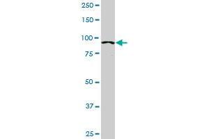 ACTN4 monoclonal antibody (M01), clone 4D10. (alpha Actinin 4 抗体  (AA 592-701))
