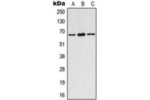 Western blot analysis of Estrogen Receptor alpha (pY537) expression in HeLa (A), SP2/0 (B), rat spleen (C) whole cell lysates. (Estrogen Receptor alpha 抗体  (C-Term, pTyr537))