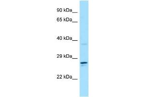 WB Suggested Anti-CSF2RA Antibody Titration: 1. (CSF2RA 抗体  (C-Term))