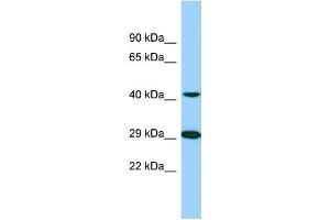 Western Blotting (WB) image for anti-Tubulin tyrosine Ligase-Like Family, Member 1 (TTLL1) (C-Term) antibody (ABIN2789136) (TTLL1 抗体  (C-Term))