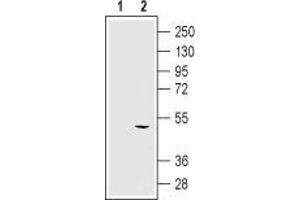 Western Blotting (WB) image for anti-Potassium Intermediate/small Conductance Calcium-Activated Channel, Subfamily N, Member 4 (KCNN4) (Extracellular) antibody (ABIN7044556)