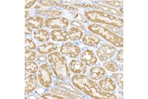 Immunohistochemistry of paraffin-embedded mouse kidney using MK4 Rabbit mAb (ABIN7268653) at dilution of 1:50 (40x lens). (MAP3K4 抗体)