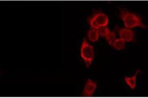 ABIN6266593 staining HepG2 by IF/ICC. (MMP16 抗体  (C-Term))