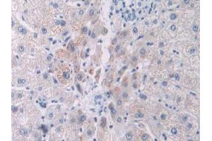 Used in DAB staining on fromalin fixed paraffin- embedded liver cancer tissue (PCOLCE 抗体  (AA 315-437))